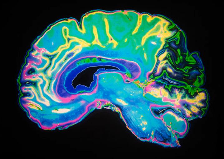 Music as Medicine - Neurological and Psychological Benefits - Part 9