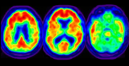  Functional Neuroscience Techniques