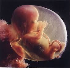 Abortion: Sanctity of Life Argument