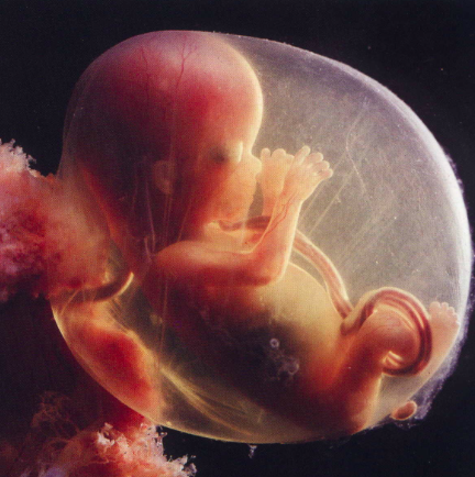 The abortion debate 2